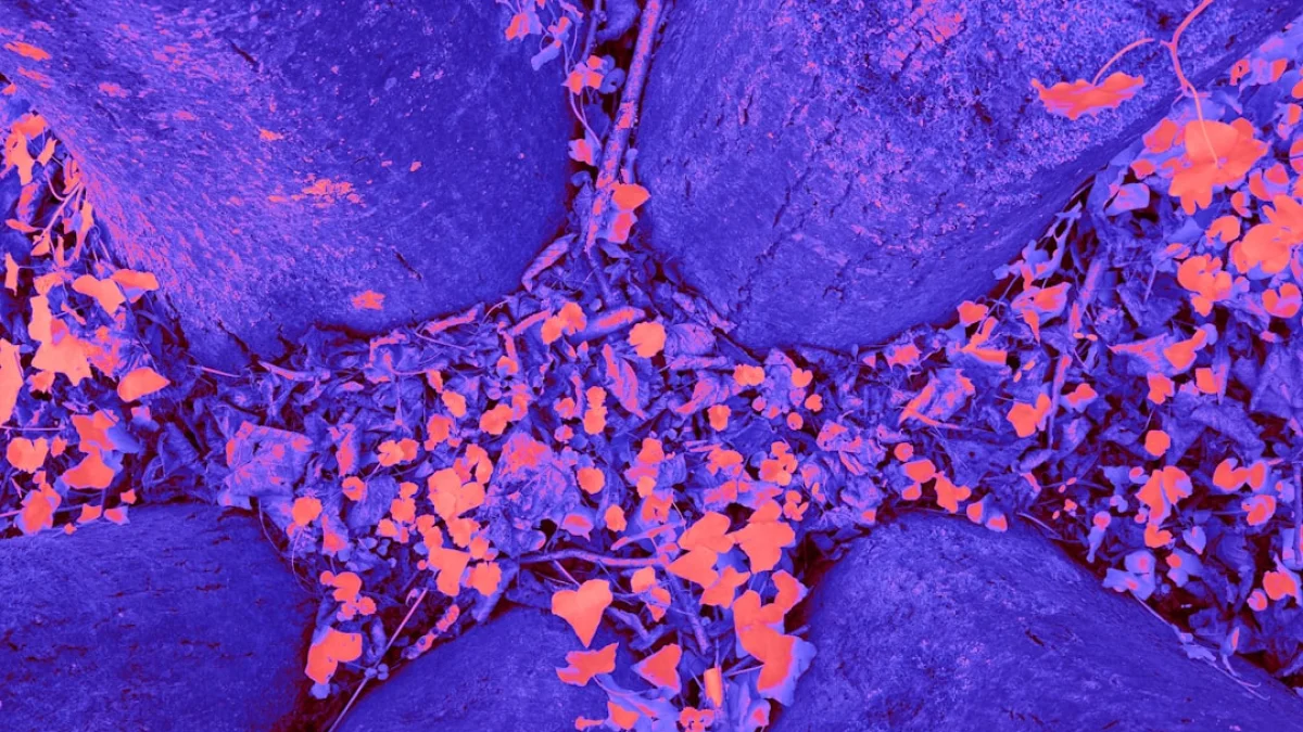 非造影CTで膵臓がん発見を目指すAI『PANDA』