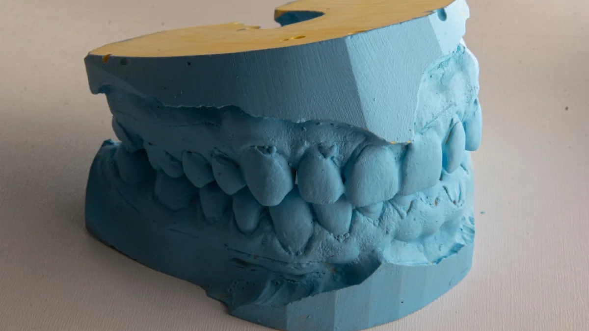 Invisalignが3Dプリンタ最大級の利用者に